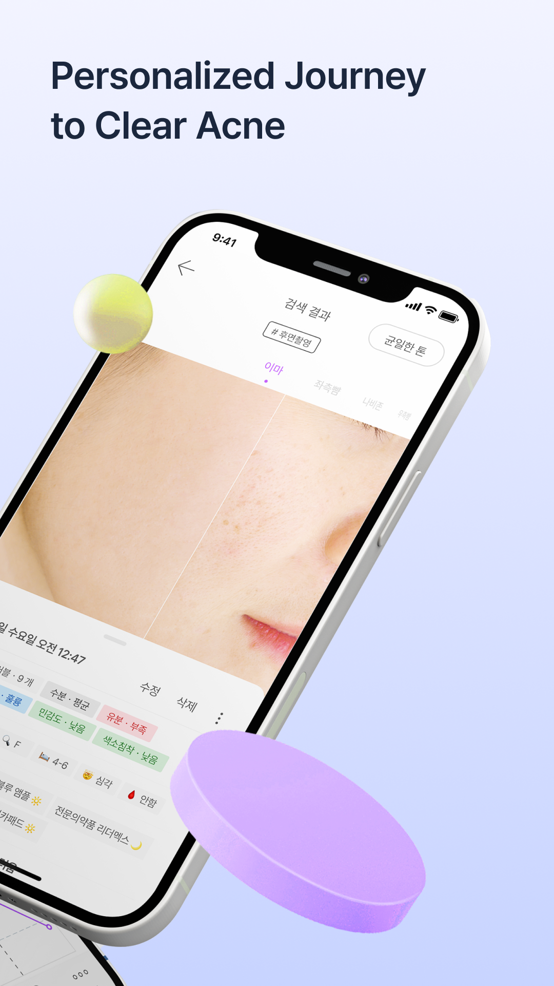 SkinLog | Acne diary APK screenshot