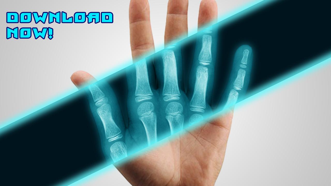 Best X-Ray FREE screenshot