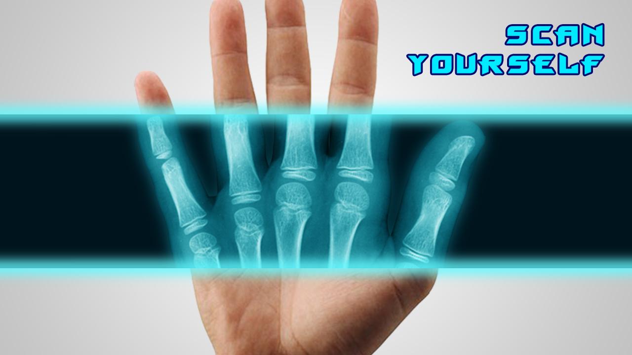Best X-Ray FREE screenshot