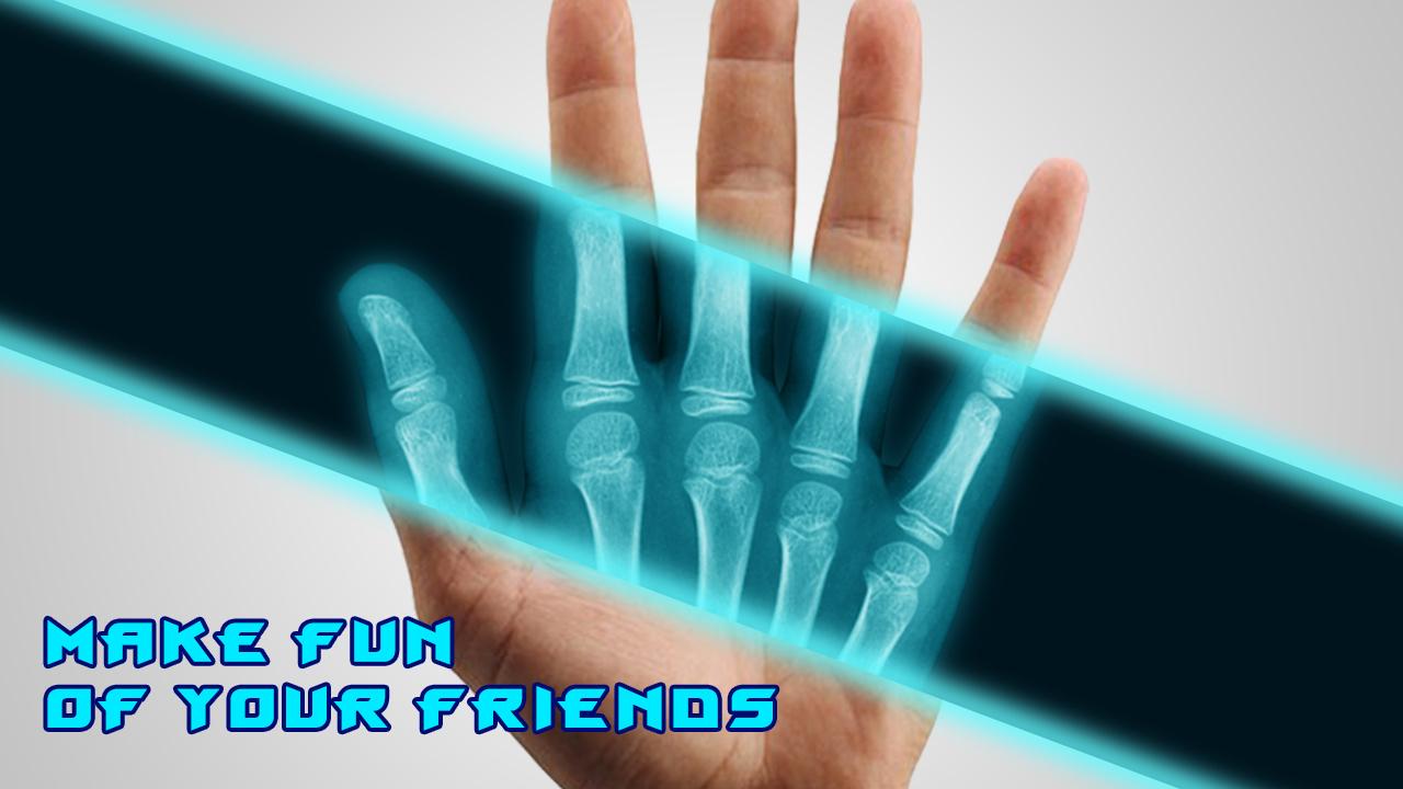 Best X-Ray FREE screenshot